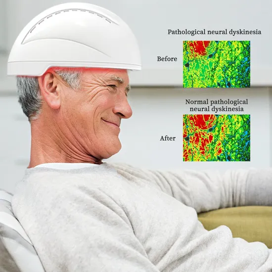 Suyzeko Neurostimulationshelm Infrarot-Lichttherapiegerät für die Photobiomodulationstherapie